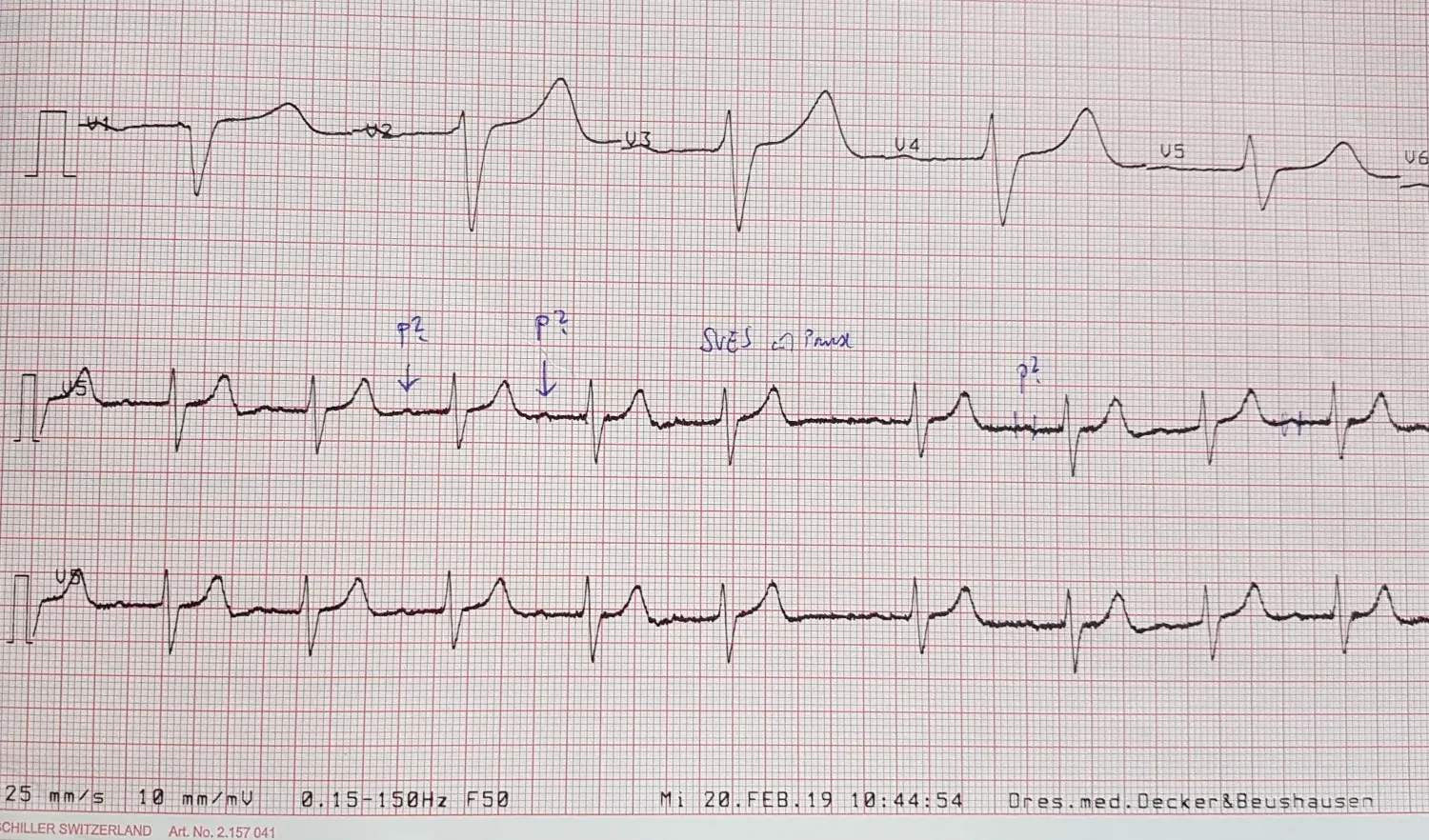 A printout of a clinical 12-lead ECG used as the reference measurement